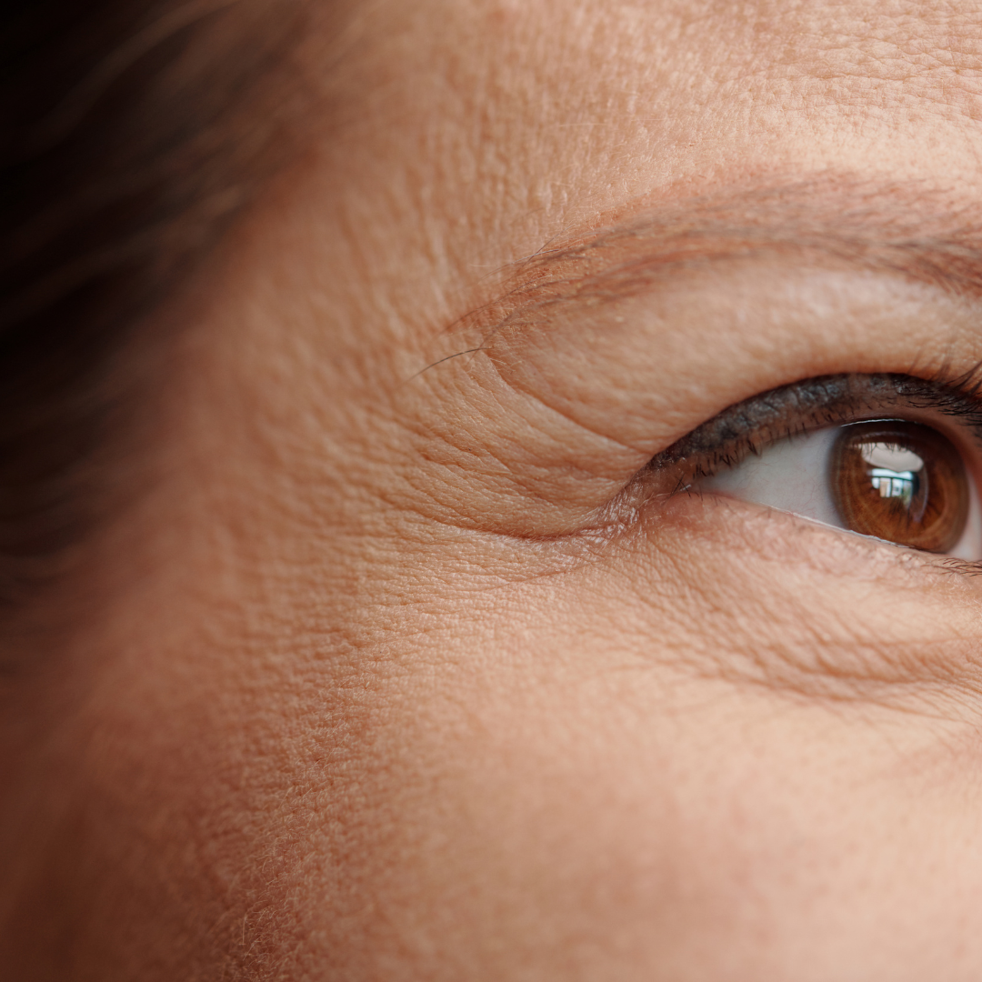Signs of ageing
